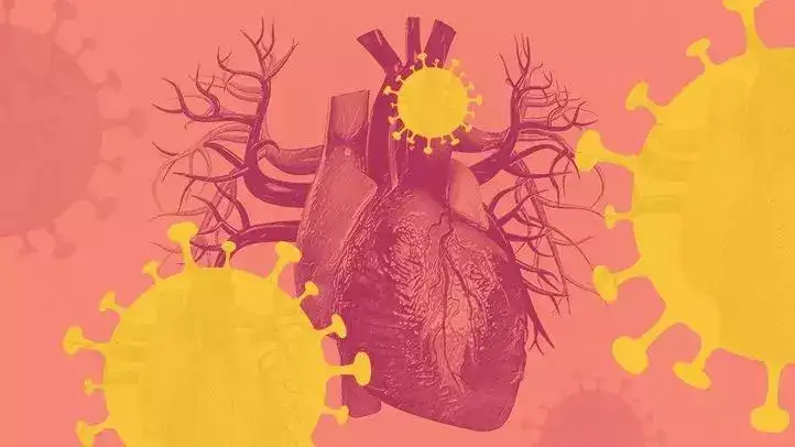 Reacting To Cardiac Pain: A Guide To Swift Action For Heart Health