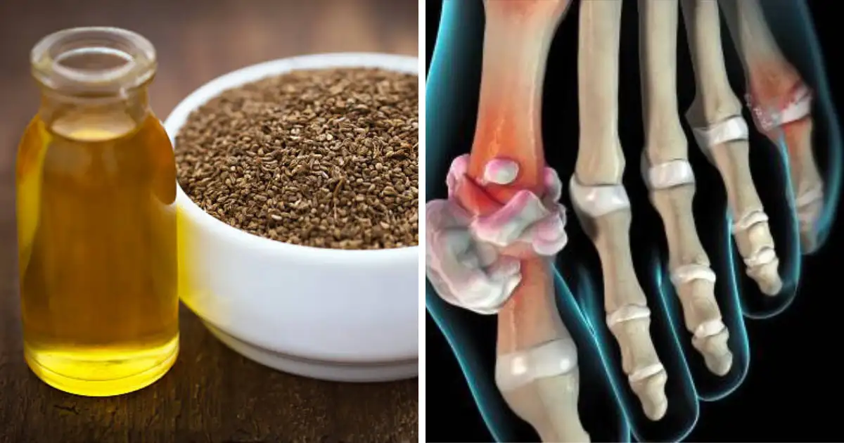 Ajwain Oil To Control Joint Pain And Get Rid Of Gout Problem How To Consume It; सांधेदुखी होईल