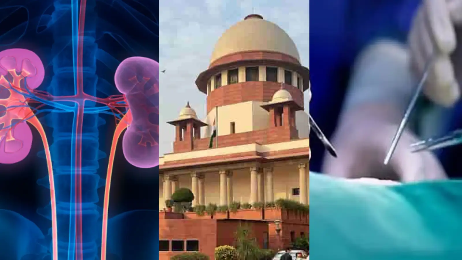 கிட்னி திருட்டு விவகாரம் : எஸ்ஐடி-யே விசாரணை நடந்தும்- தமிழக அரசு மேல்முறையீடு மனு - நிராகரித்த நீதிமன்ற! 