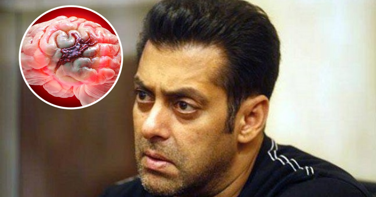 Salman Khan Disease Name,उलझकर फट जाती हैं दिमाग की नसें...बाहर से  हट्टा-कट्टा दिख रहे सलमान को अंदर से खा रही 3 बीमारियां - on netflix kapil  sharma show salman khan reveals he