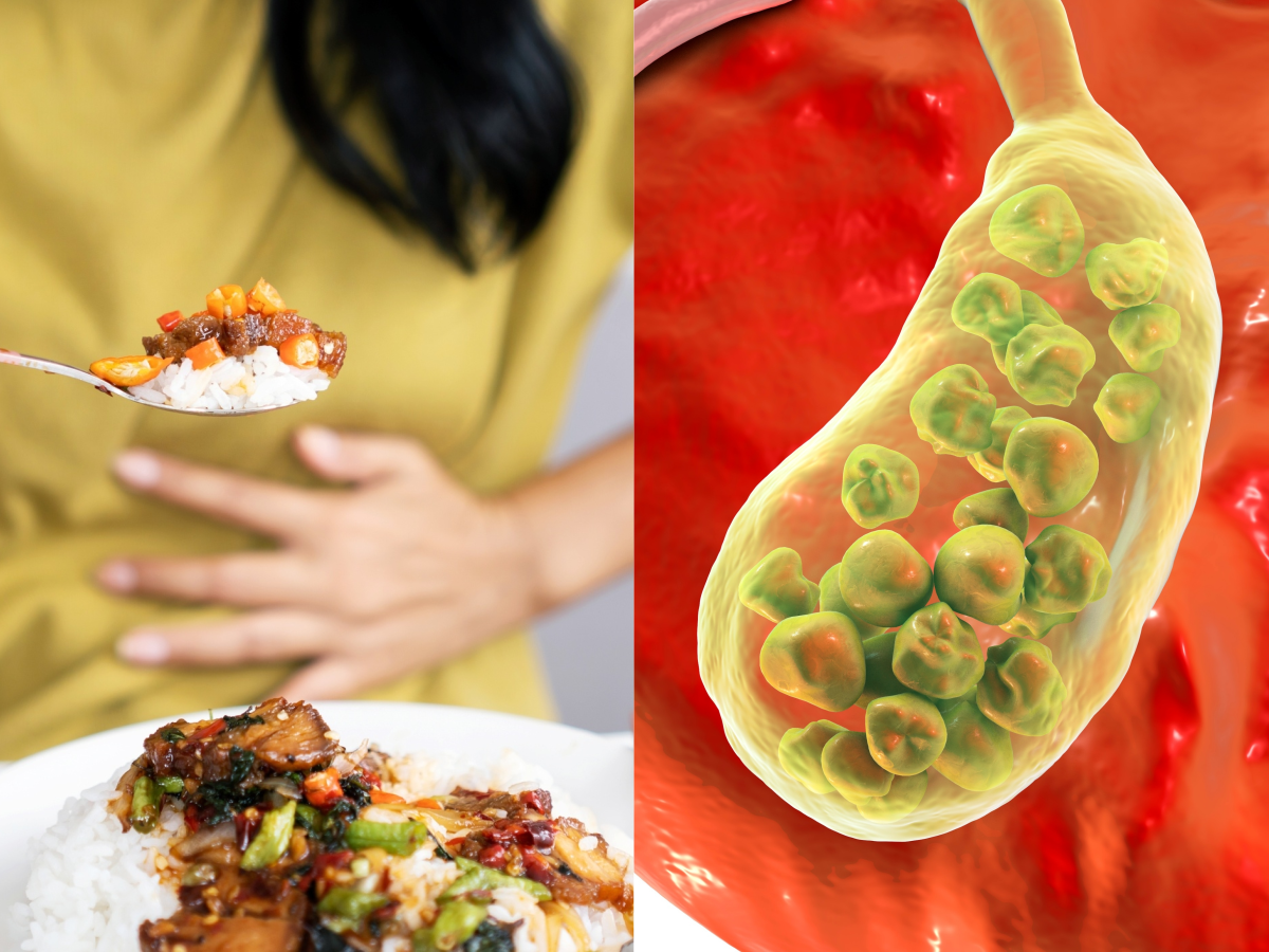 do-not-eat-heavy-food-for-4-to-6-weeks-after-gall-bladder-operation-dr