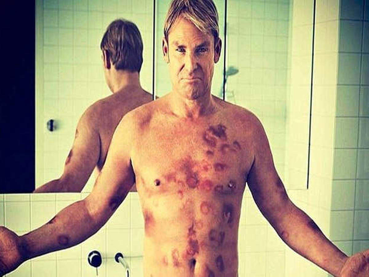 Shane Warne In Sex Issues,फिर सामने आई शेन वॉर्न की रंगीनमिजाजी, गर्लफ्रेंड  और सेक्स वर्कर्स के साथ दिखे - shane warne once again infamous he has four  way romp with his lover