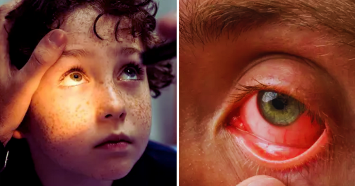 Such children are at the highest risk of eye cancer, Dr. told about prevention and treatment