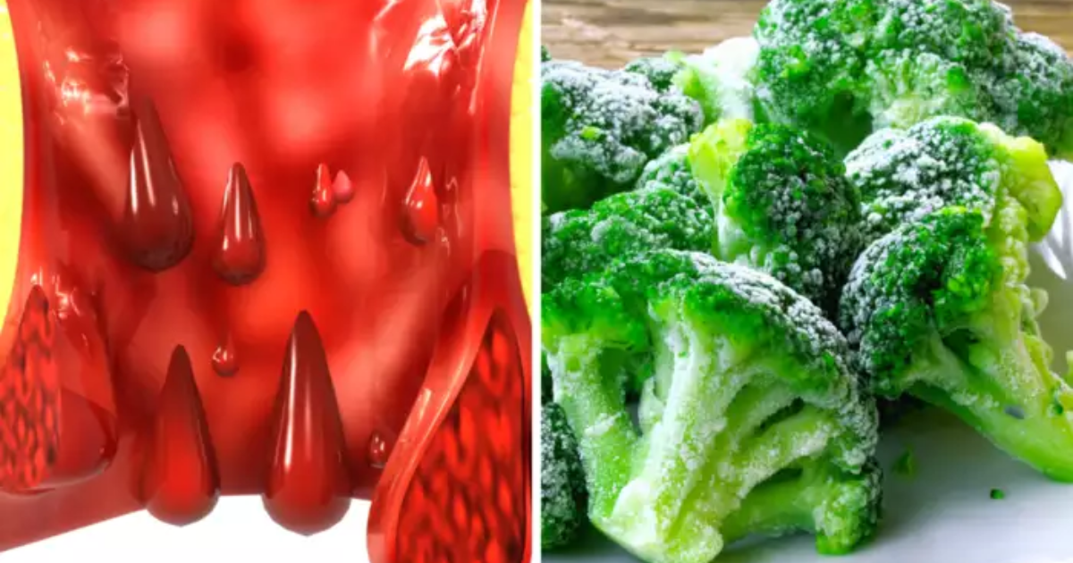 these-7-foods-harmful-and-causes-for-constipation-piles-or-hemmorides
