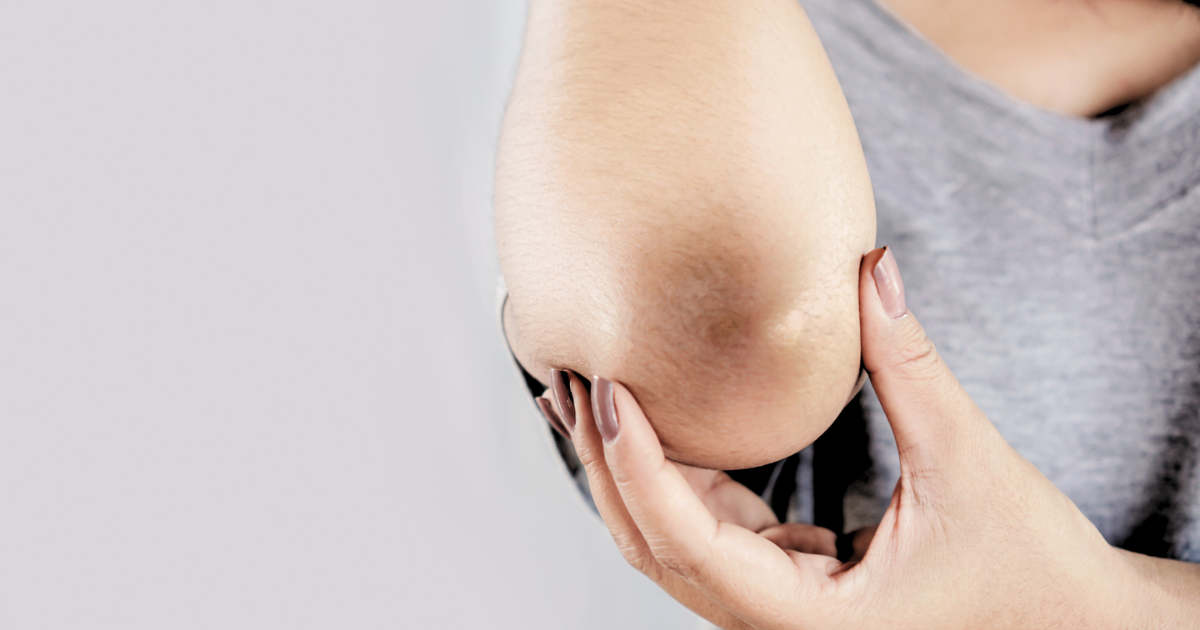 You will not be embarrassed about dark knees and elbows, take care of these things