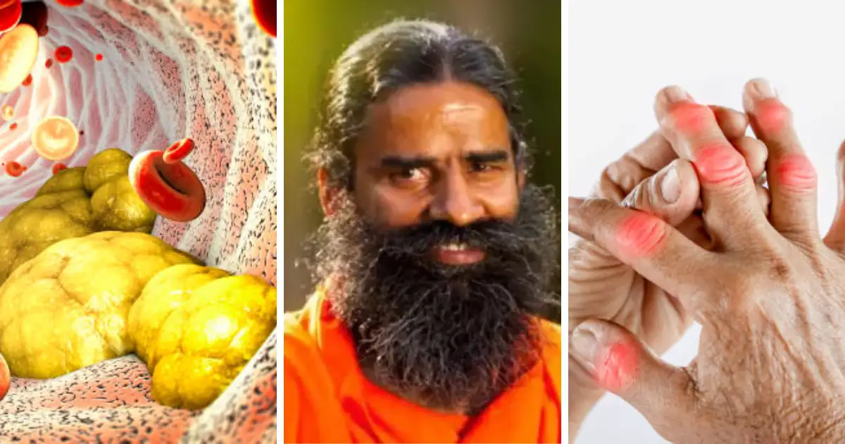 Baba Ramdev on How to Detox Body at Home and Control Cholesterol & Uric