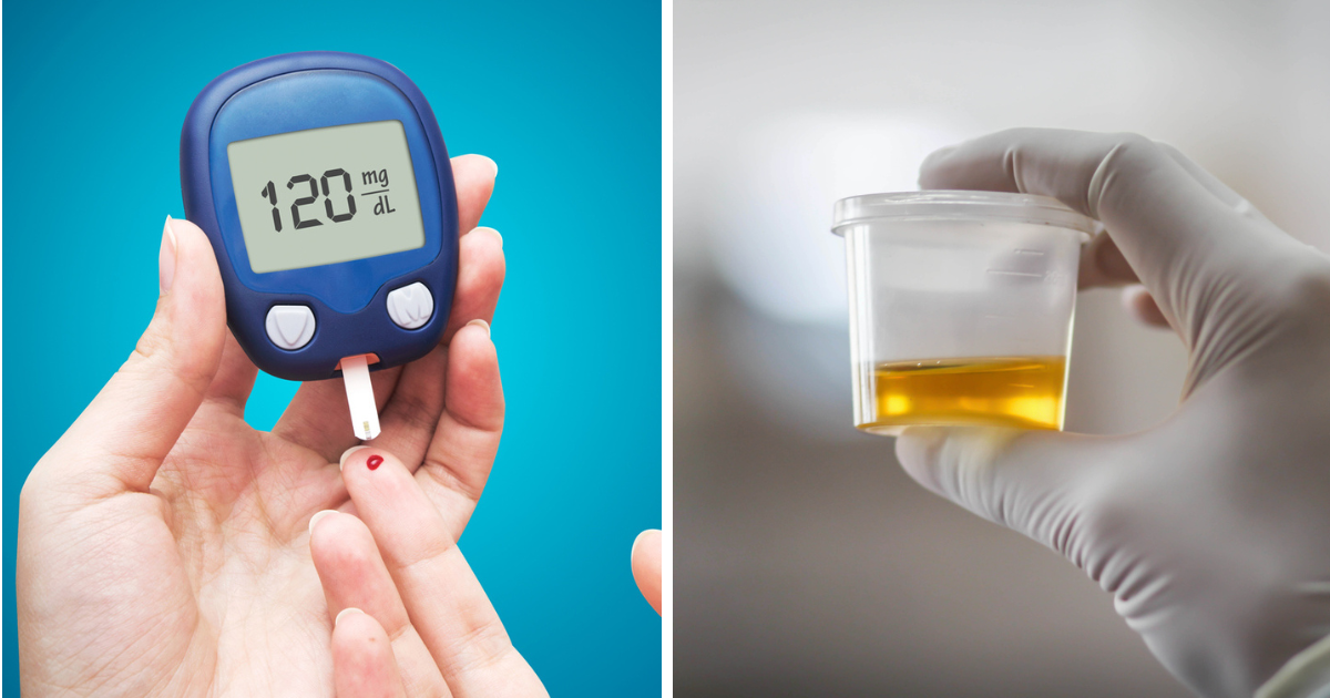 urine-has-become-thick-the-edge-is-less-get-sugar-checked-as-soon-as