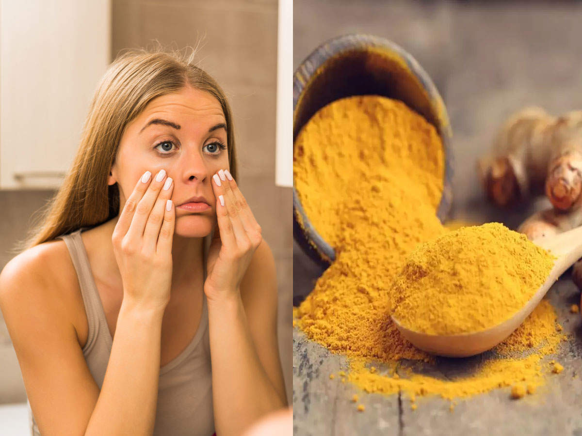 Dark Circles,Dark Circles दूर करने में मदद करेगी हल्दी, ऐसे करें यूज -  turmeric may help in reducing dark circles problem right way to use it -  Navbharat Times