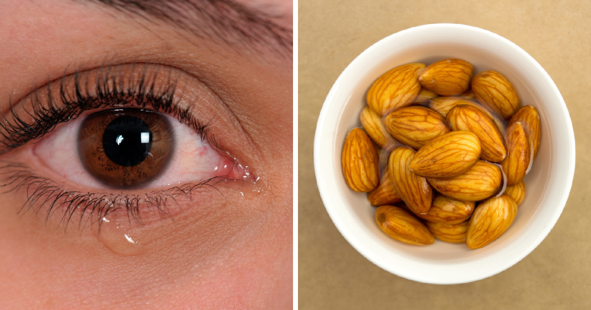 Eyes go away quickly by not eating 7 foods, cataract operation will have to be done in youth