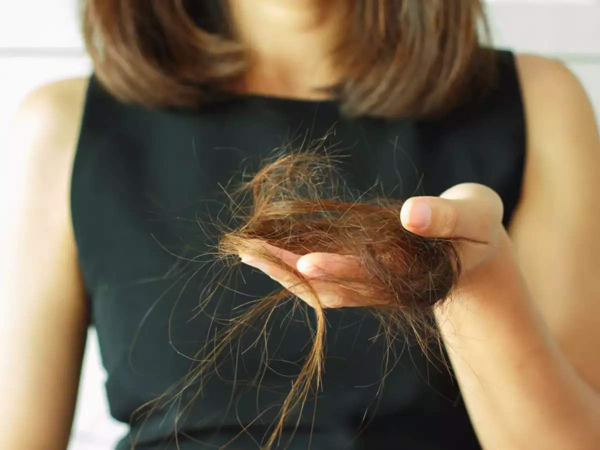 8 Best Ways to Prevent Hair Loss in tamil  Live in Tamilnadu