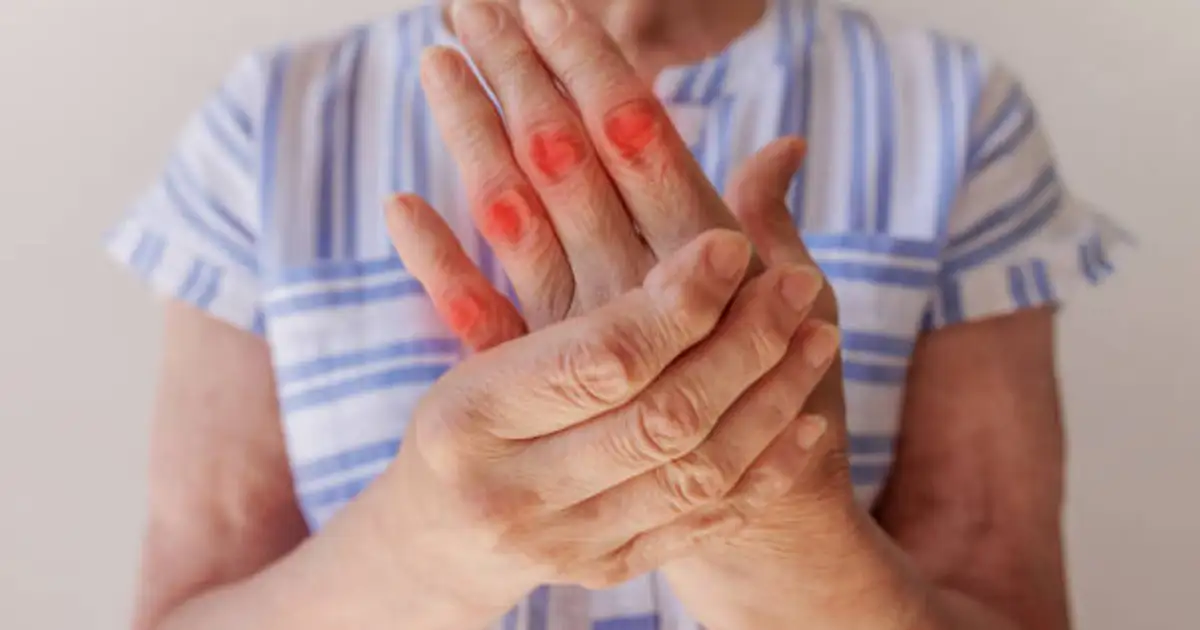 Home Remedies Foods Fruits Vegetables For Reduce Uric Acid Naturally