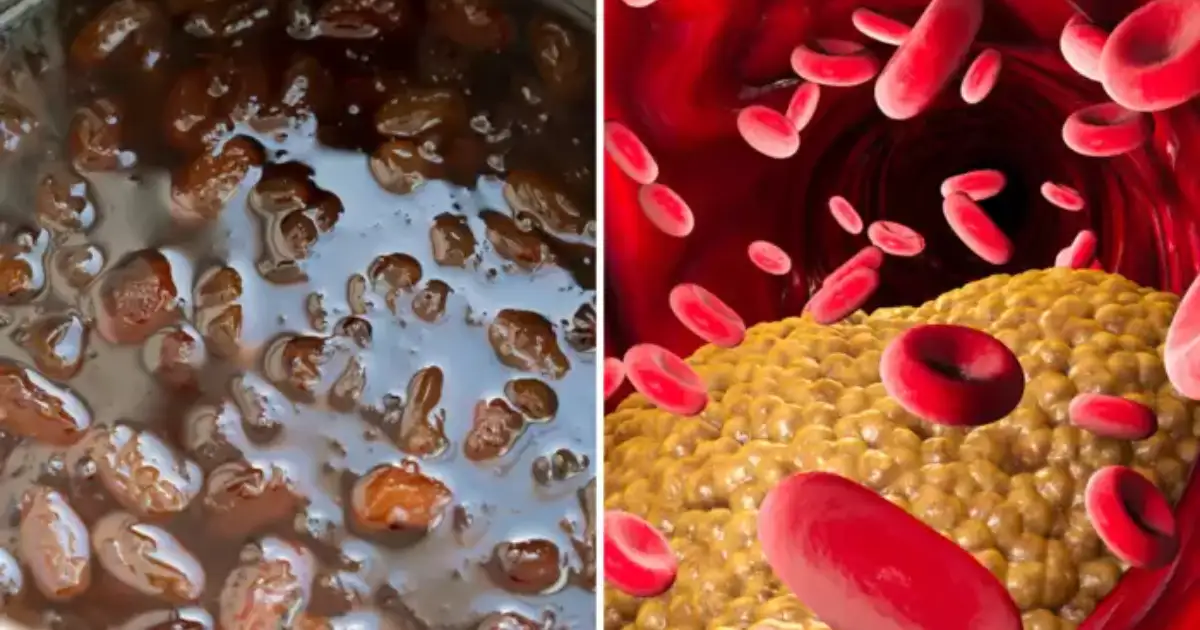 Raisin Water For Cholesterol Diabetes Weight Loss लठ्ठपणा