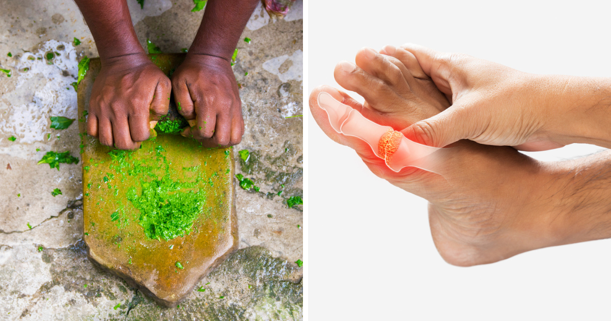 Neither medicine nor doctor, these 5 Ayurvedic herbs will eliminate uric acid in joints!