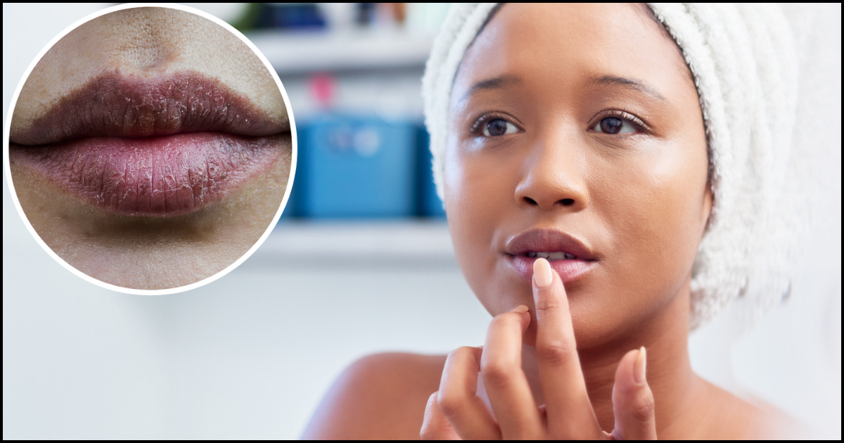 You will not need lip balm to make black lips pink, try this easy method