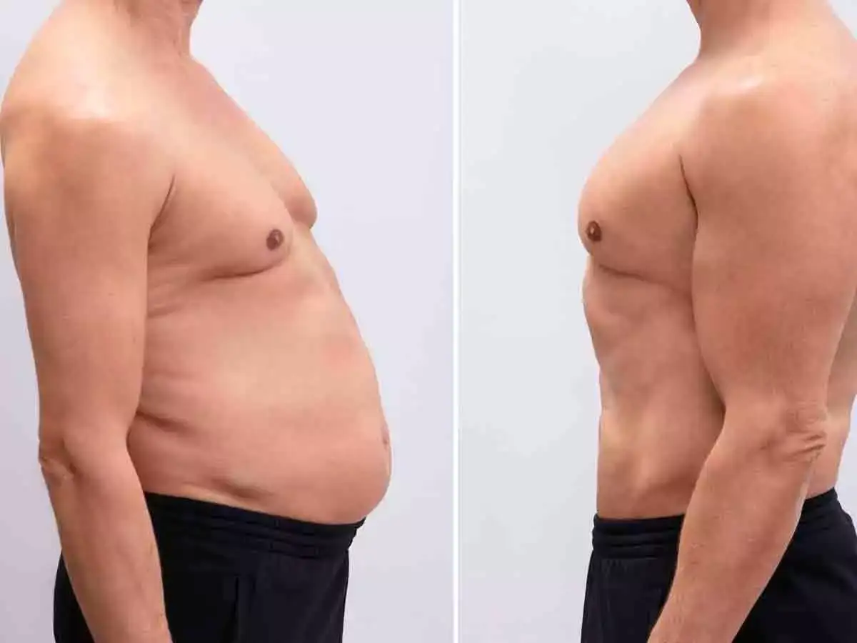 Толстый живот у мужчин фото. Живот у мужчин после 40 почему растет. Живот у мужчин после 40 почему растет. Живот у мужчин после 40 почему растет. Ожирение.