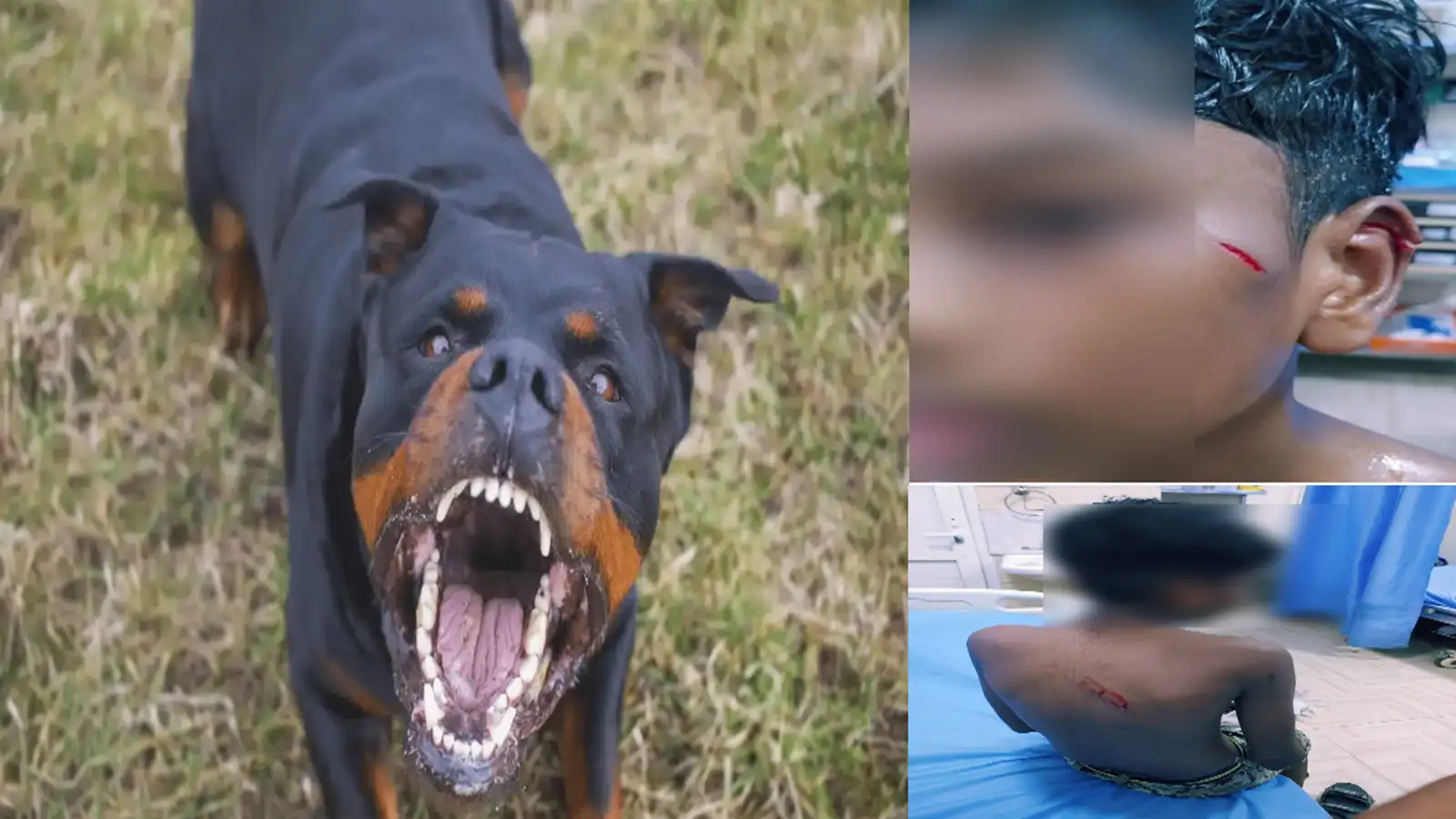 சென்னையில் மீண்டும் ராட்வீலர் நாய் கடித்து பள்ளி சிறுவன் படுகாயம்! 