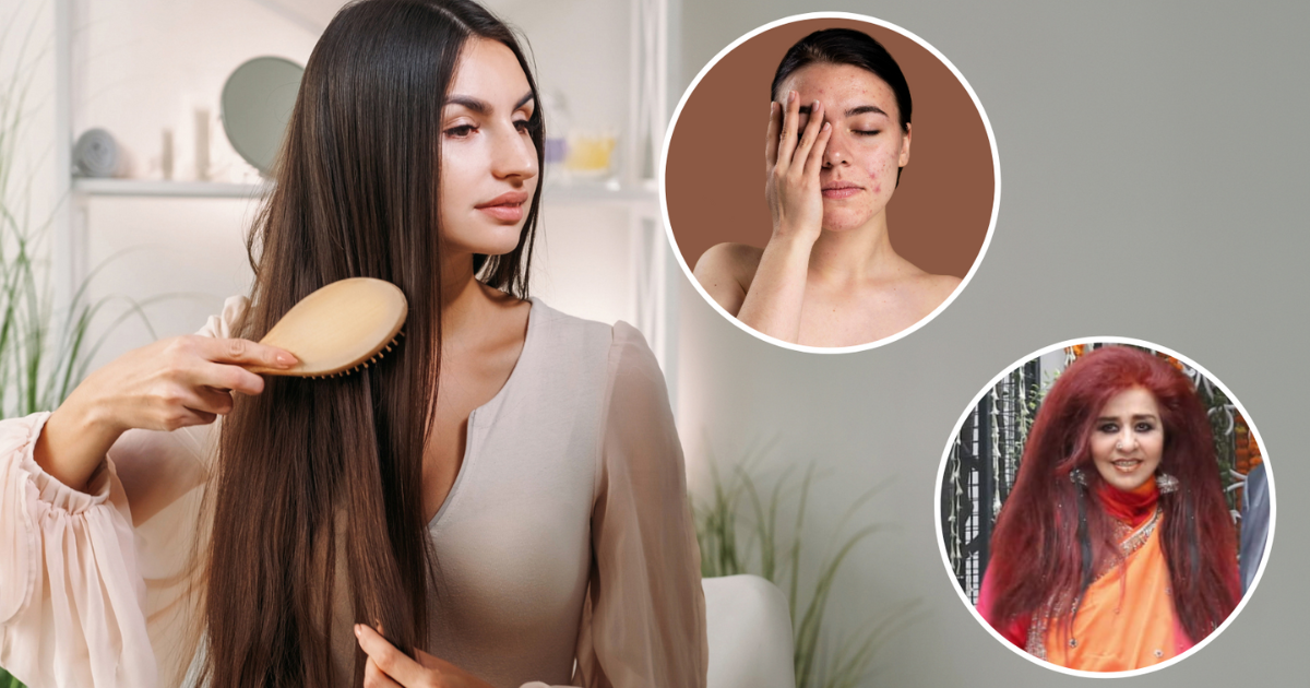 From split ends to pimples on the face, Shahnaz Hussain has a solution for every problem