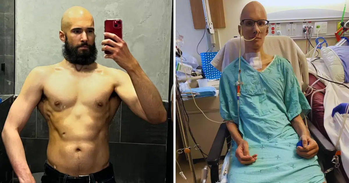 Rare Deadly Disease In The World,जुकाम से पहलवान को हुई गंभीर बीमारी