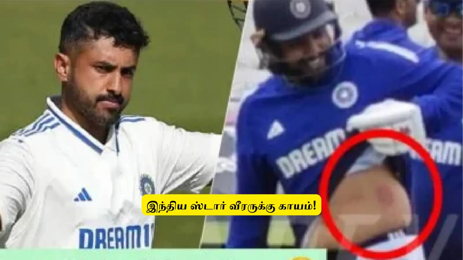 IND vs ENG Test : ‘இந்திய ஸ்டார் வீரருக்கு காயம்’.. பயிற்சியின்போது நடந்த சம்பவம்: முதல் போட்டியில் விலக வாய்ப்பு! 