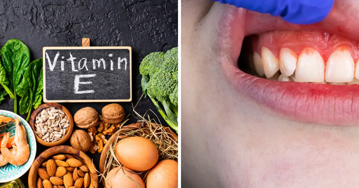 Vitamin E Rich Foods,VitaminE Rich Foods शरीर को कंकाल बना देगी