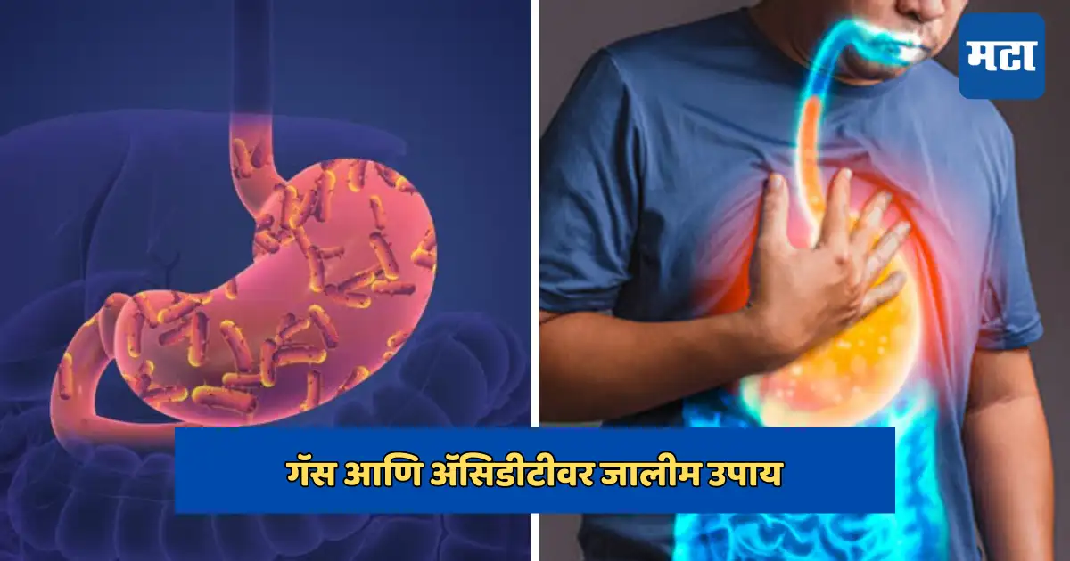 how to get rid of gas and bloating amazing benefits of fennel seeds;गॅस