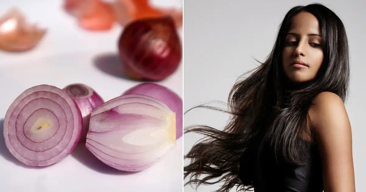 Hair ReGrowth Tips: શું તમે પણ કરી રહ્યા છો ડુંગળીના રસનો ખોટી રીતે ઉપયોગ? આ રીતથી બેગણા ઝડપથી વધશે વાળ - dermatologists shares correct way of using onion juice for hair regrowth -