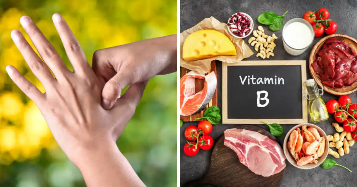 Vitamin B12 Deficiency Symptoms, Sings And Foods, Fruits, Diet For