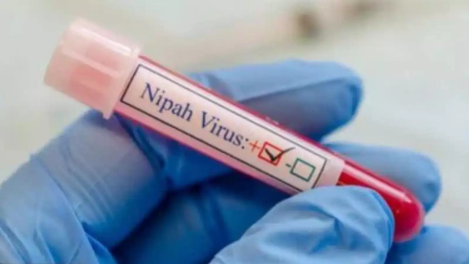 கேரளாவில் நிபா வைரஸ் பாதித்த பெண்ணின் உடல்நிலை கவலைக்கிடம்... பீதியில் மக்கள் 