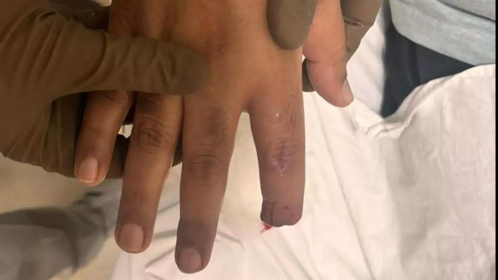 வாடகை கேட்டது ஒரு குத்தமா? பெண்ணின் விரலைக் கடித்து துண்டாக்கிய இளைஞர்.. தட்டித்தூக்கிய போலீஸ்! 