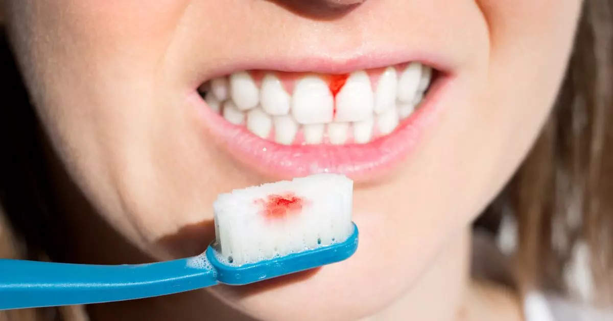 Are you troubled by sensitivity? These 5 things spoil your teeth quickly, if you stay away from them, you will live longer