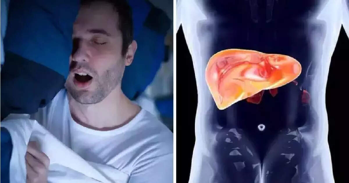 fatty-liver-can-be-caused-by-bad-sleeping-habits-what-is-remedies-or