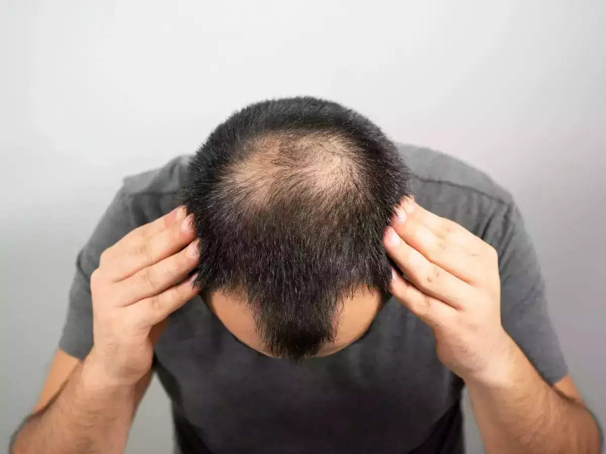 Rapid return of hair in areas that have fallen out like baldness
