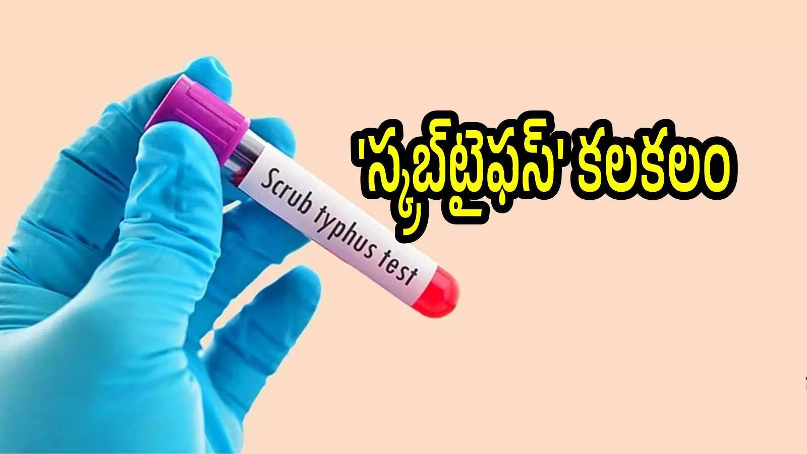 ఏపీలో స్క్రబ్‌టైఫస్‌ కలకలం.. అక్కడ 4 కేసులు, పిల్లలపై ప్రభావం ఎక్కువ.. లక్షణాలివే