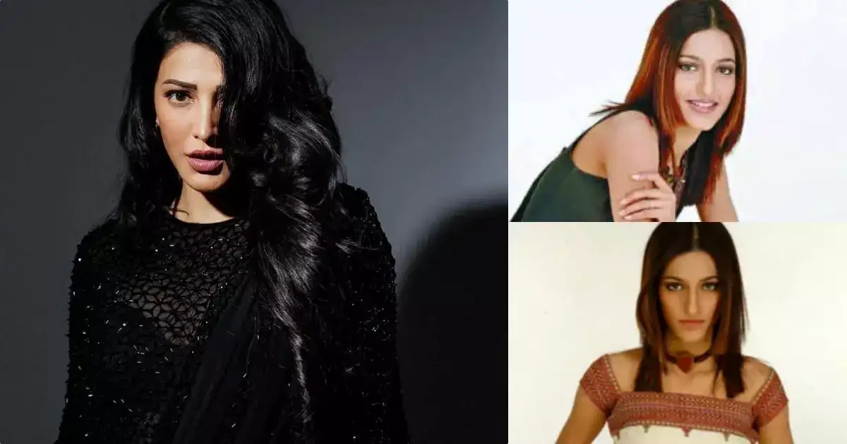 എന്റെ മുഖം, ഞാൻ ചെയ്തു, അതിൽ ആർക്കാണ് പ്രശ്നം; പ്ലാസ്റ്റിക് സർജറി ചെയ്തു എന്ന് അം​ഗീകരിച്ച് ശ്രുതി ഹാസൻ ഹറഞ്ഞത്