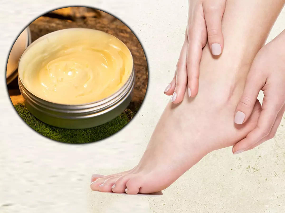 Saniderm Cracked Heel & Foot Cream 50ml | Deeply Moisturizes, Softens &  Heals Dry, Rough & Cracked Heels and Feet