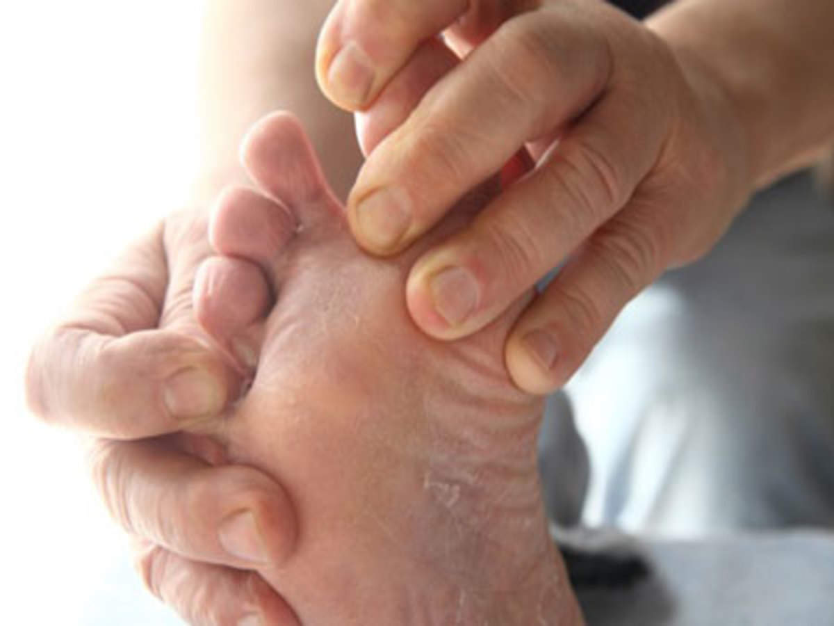 Foot Care For Diabetes,நீரிழிவு நோயாளிகள் ...