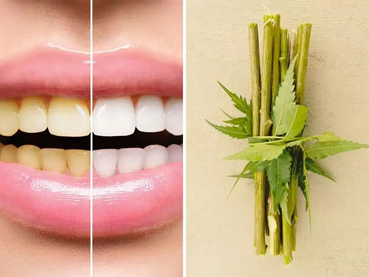 बदबूदार सांस से छुटकारे के साथ मिलेंगे मोतियों से चमकदार दांत, हफ्ते में बस  2 बार करें ये मुफ्त का रामबाण उपाय - sports nutritionist nidhi gupta shared  brushing with ...
