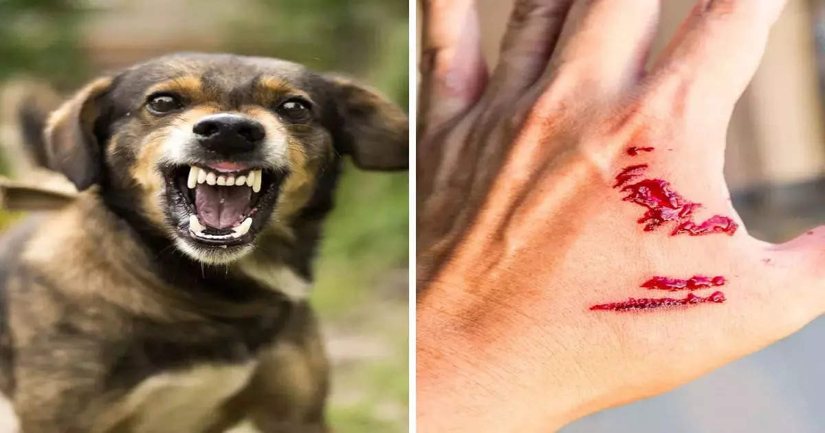 Dog bite 2025 treatment in marathi