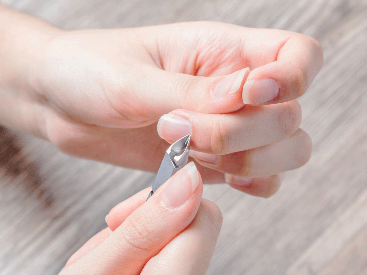 Peeling Cuticle DIY Home Solution,Cuticle Peeling: निकलने लगी है नाखूनों के  किनारे की खाल तो ये घरेलू नुस्खे देंगे दर्द से तुरंत राहत - cuticle peeling  pain home remedies and nail care