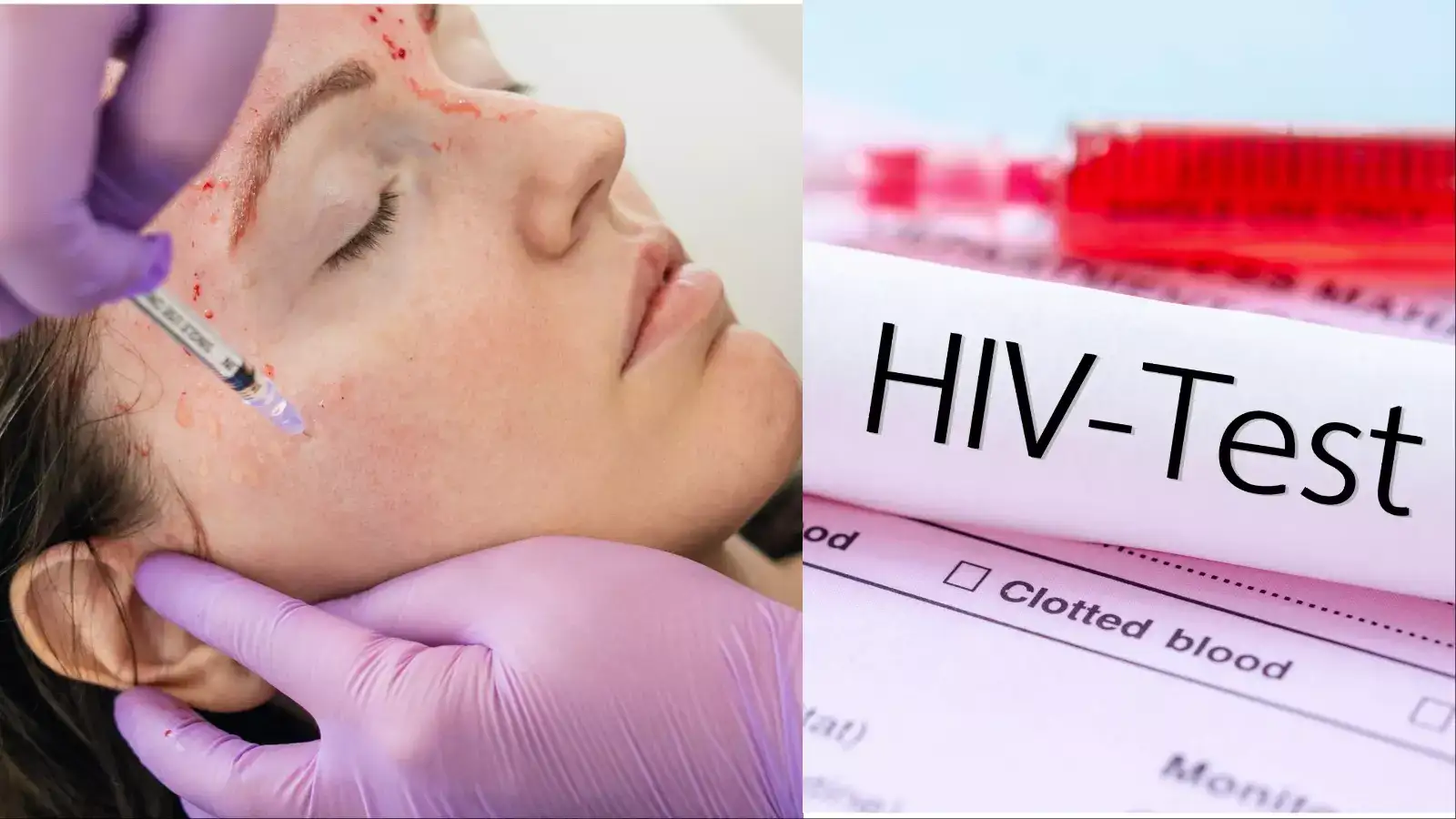 பேஷியல் பண்ணா எய்ட்ஸ் வருதா ? வேம்பையர் பேஷியல் செய்த மூன்று பேருக்கு HIV உறுதி! உஷார்! 