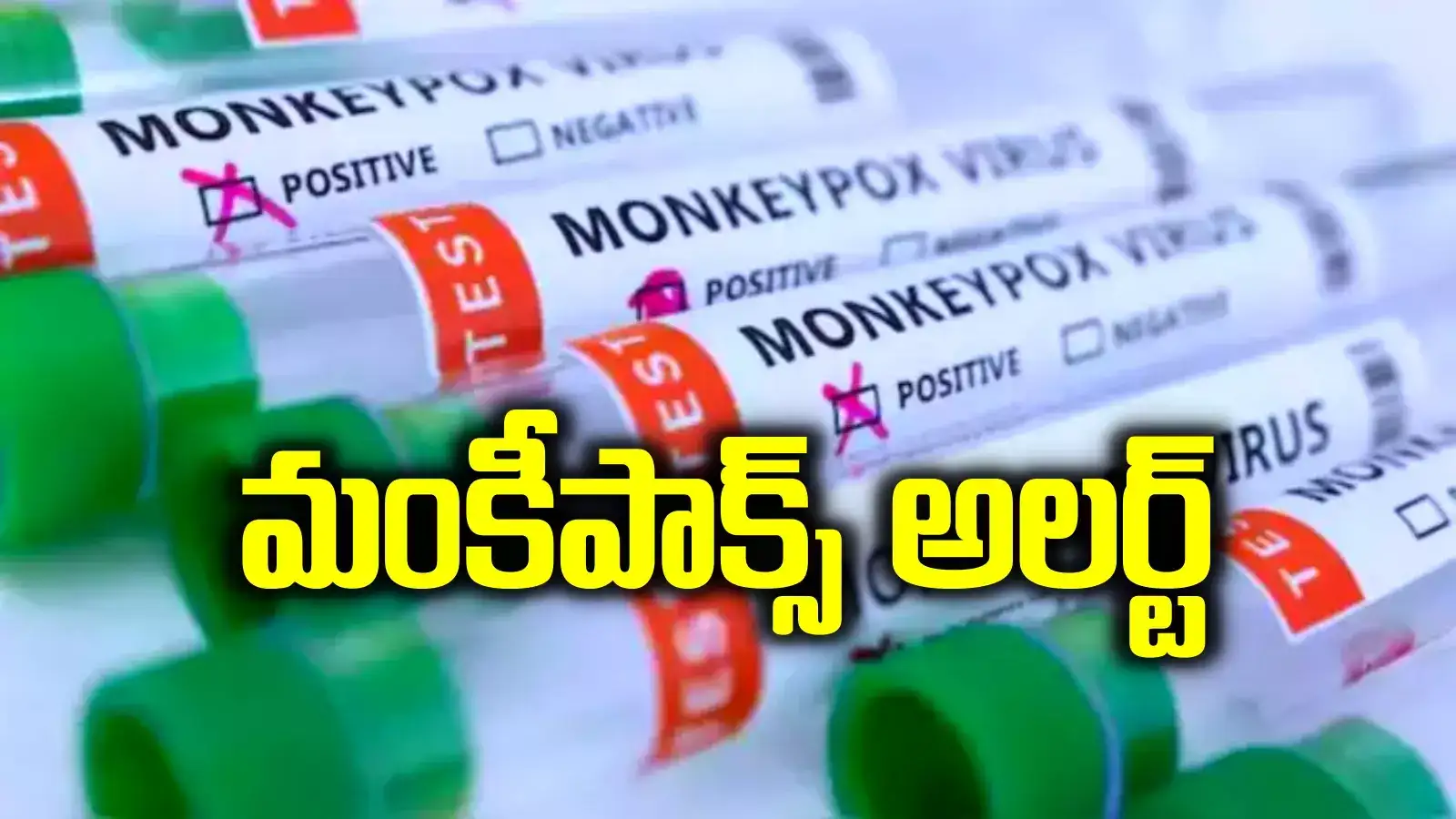 MPox: మార్కెట్‌లోకి కొత్త వైరస్.. తెలంగాణ సర్కార్ అలెర్ట్.. హైదరాబాద్‌లో ఆస్పత్రులు సిద్ధం..!