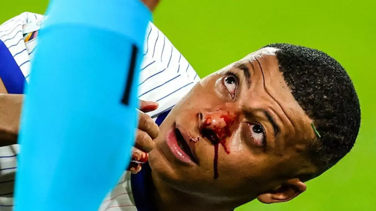 Kylian Mbappe: பிரெஞ்சு அணியின் கேப்டன் கைலியன் எம்பாப்பேவிற்கு ஏற்பட்ட காயம்..அடுத்த போட்டியில் விளையாடுவாரா ? வெளியான தகவல்..! 