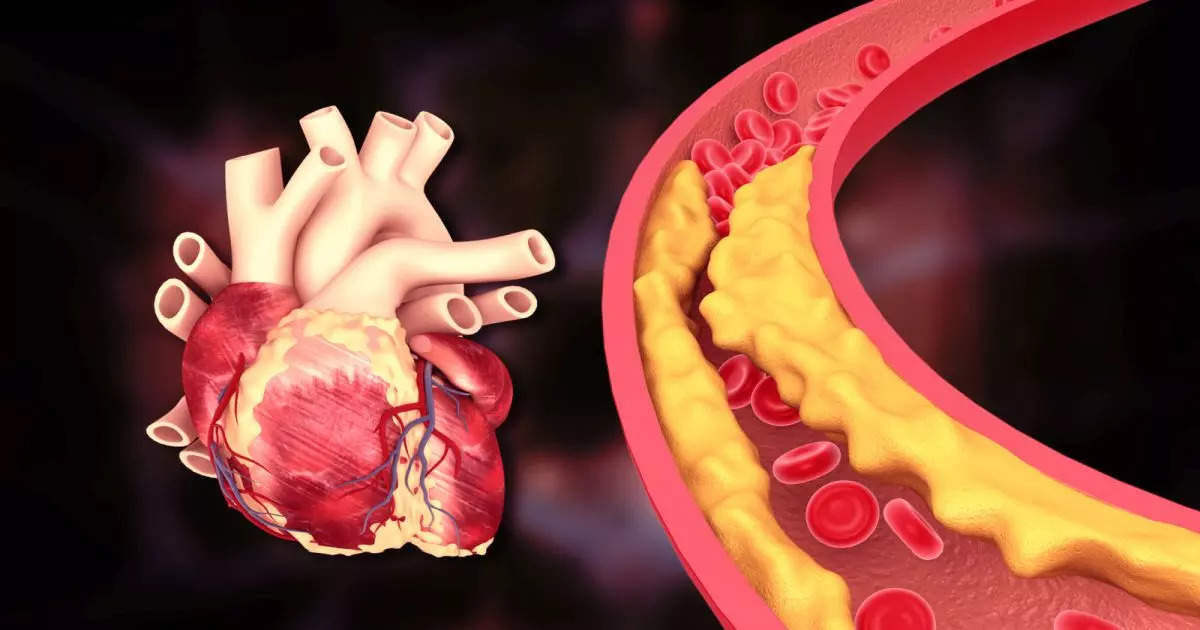 Heart Blockage Reasons: These foods can cause heart blockage, keep distance from them