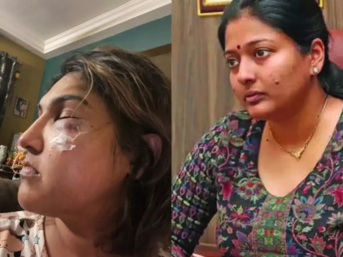 மர்மநபரால் தாக்கப்பட்ட வனிதா விஜயகுமார்.. கொந்தளித்த காயத்ரி ரகுராம்.. ஆக்ஷன் எடுங்க போலீஸ்! 