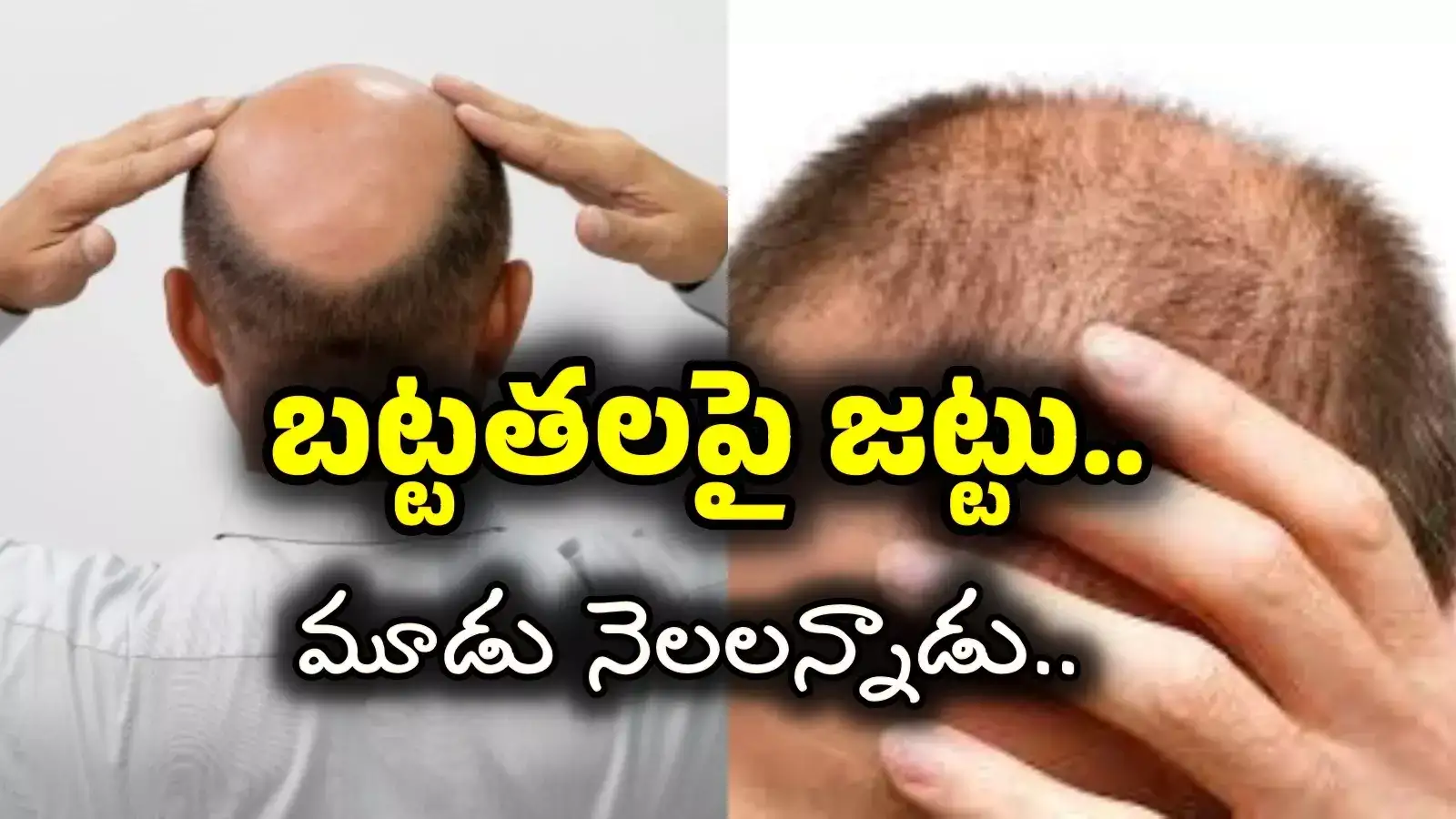 బట్టతలపై జుట్టు.. ఈ ఒక్క షాంపుతో సాధ్యమన్నాడు.. చివరకి!