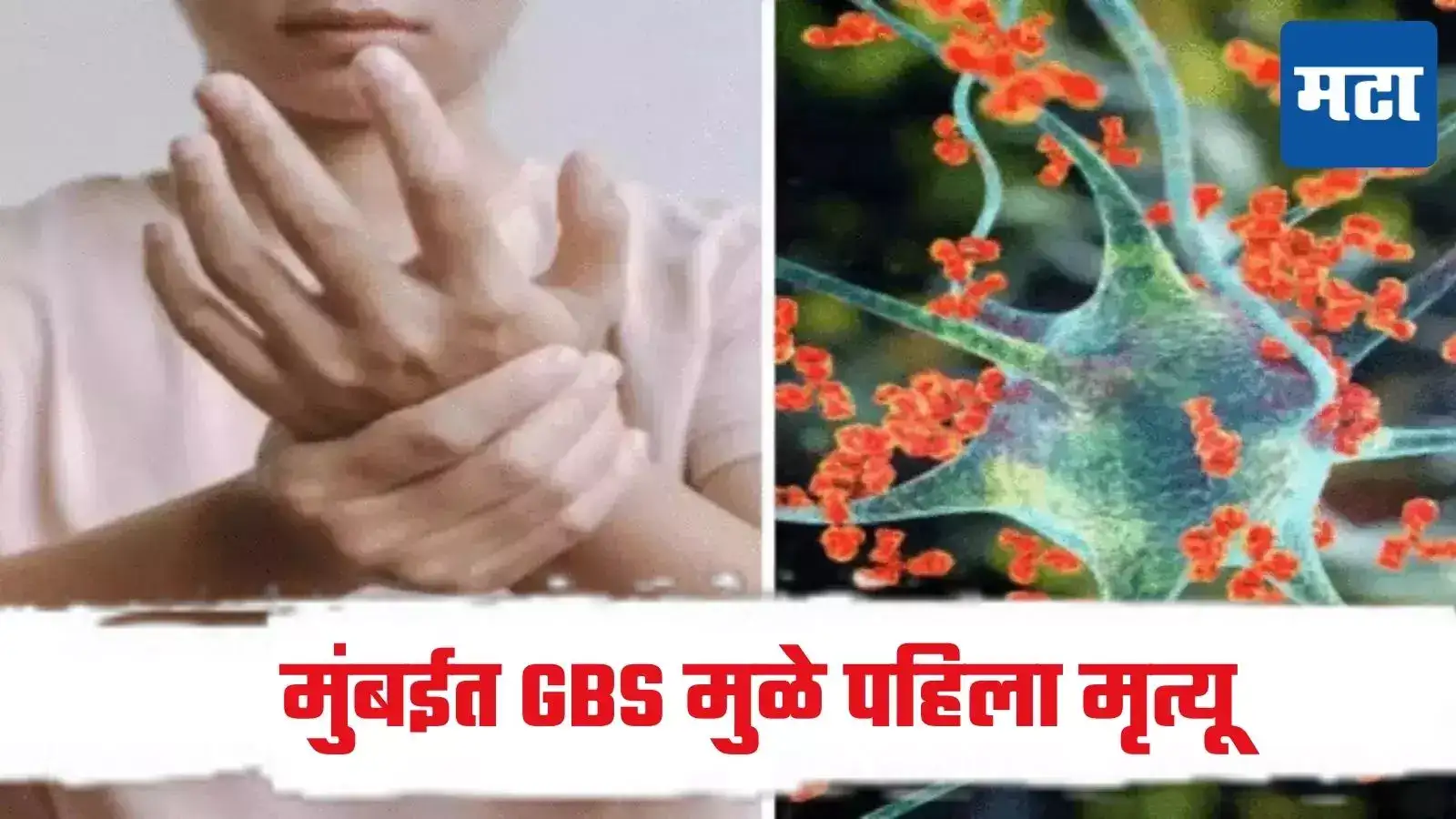 मुंबईत GBS रुग्णाचा मृत्यू, नायर रुग्णालयात अखेरचा श्वास, राज्यात आजाराची परिस्थिती काय? मुंबईत GBS रुग्णाचा मृत्यू, नायर रुग्णालयात अखेरचा श्वास, राज्यात आजाराची परिस्थिती काय?