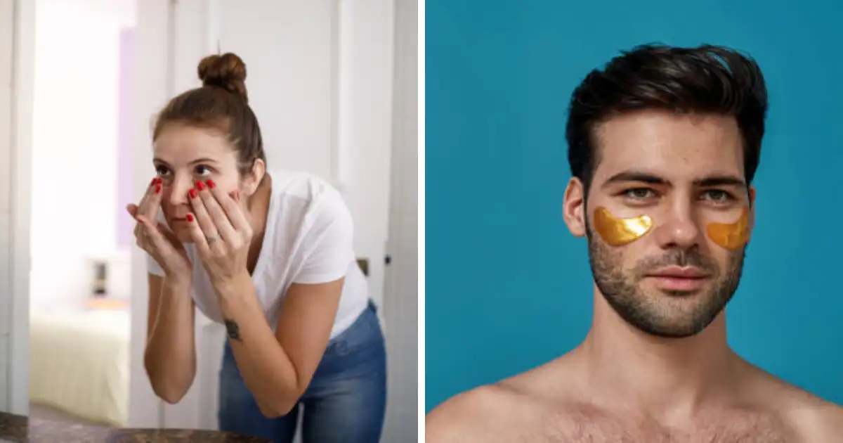 How To Remove Dark Circles Under Eyes Permanently, Can Sleeping Too