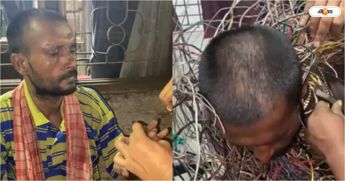 North 24 Parganas News,দেহে জড়ানো ৮-৯ কেজি লোহার তার, হাবড়ায় উদ্ধার ভবঘুরে – police and animal lovers organization has requested a man from habra north 24 parganas