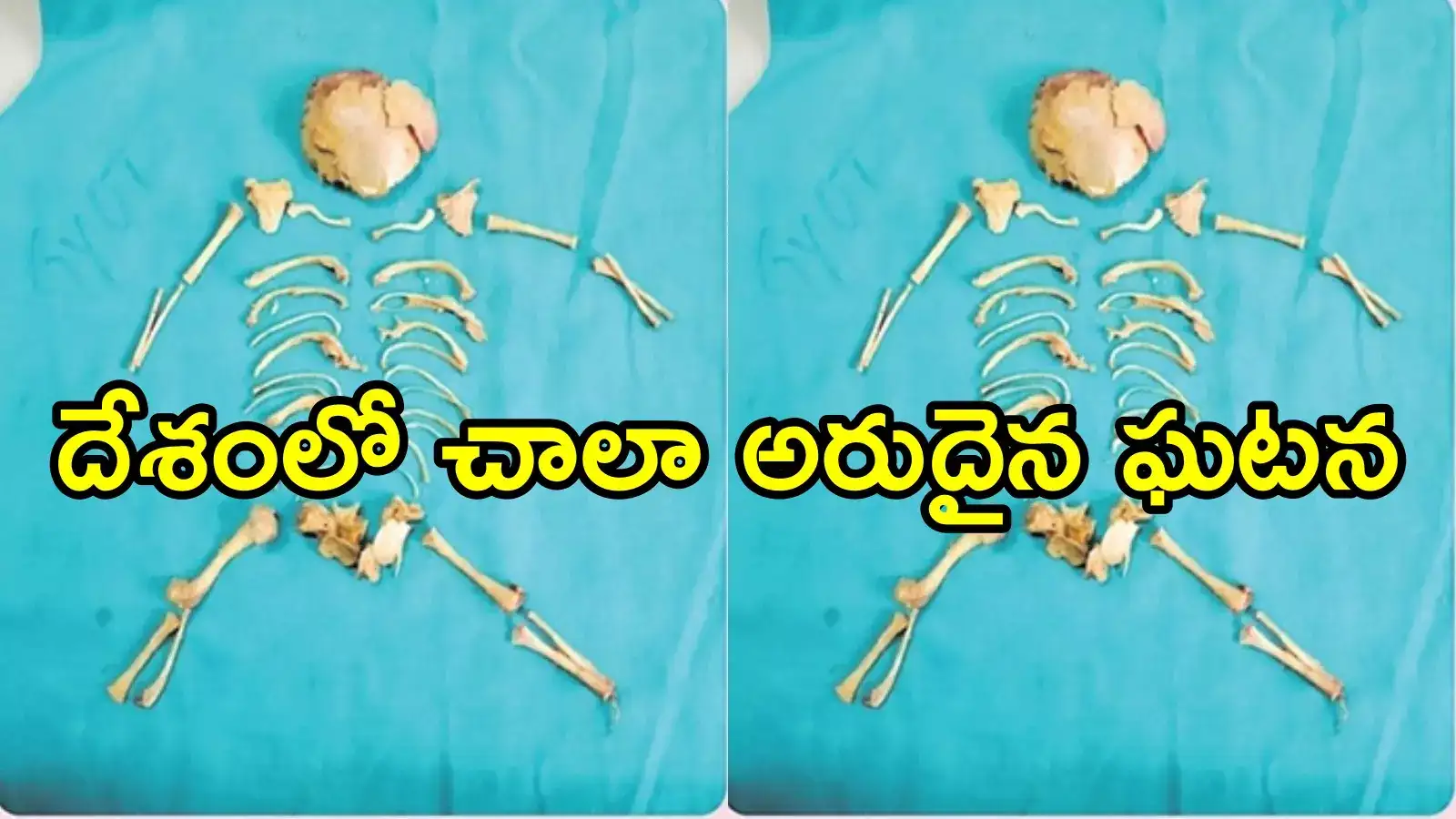 విశాఖ: కడుపునొప్పితో వచ్చిన మహిళకు స్కానింగ్.. రిపోర్ట్ చూసి డాక్టర్లు షాక్, వామ్మో ఎలా సాధ్యం