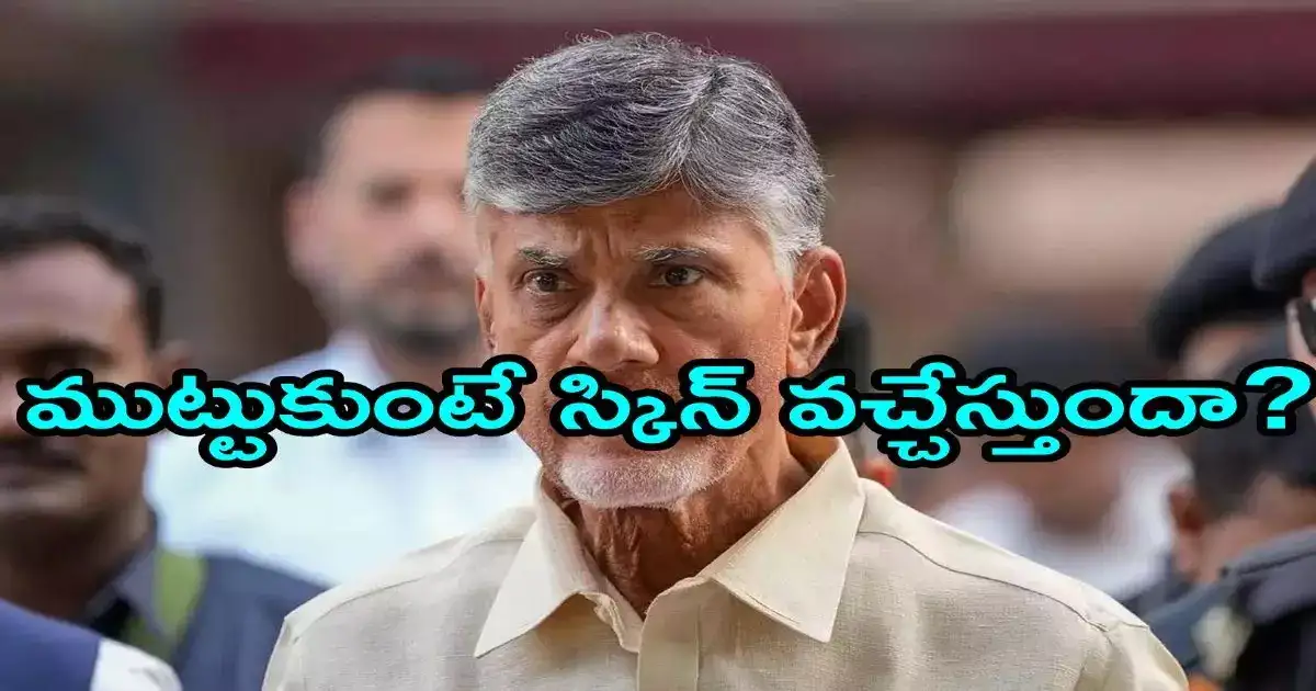 Mp Raghu Rama Krishnam Raju,చంద్రబాబుకు వచ్చిన అలర్జీ ప్రాణాంతకమా? ఎంపీ ...